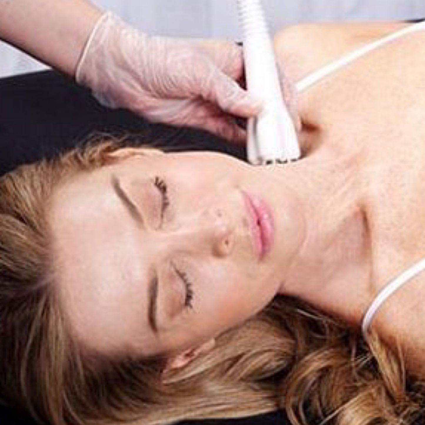 Face and Neck Skintightening Package (8 treatments)