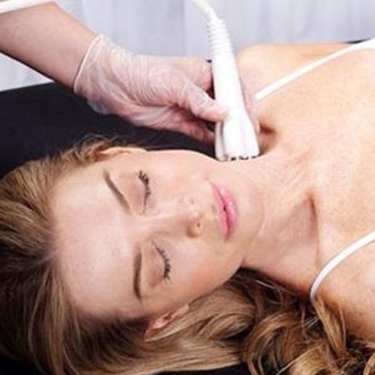 Face Neck and Decolletage Skintightening