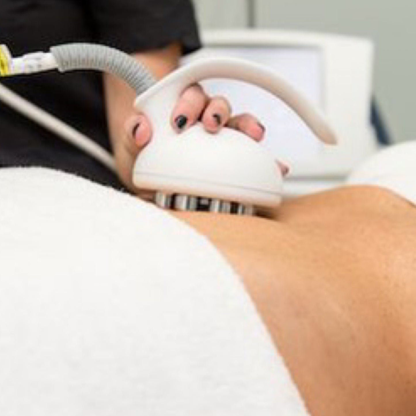 Venus Treatment