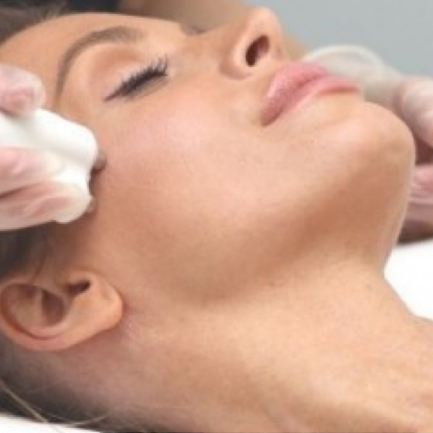 Face Skintightening